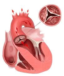 Penyakit jantung sering disebut sebagai 'silent killer' karena anda tidak tahu kapan terjadi dan apa gejalanya. Kenali 7 Jenis Penyakit Jantung Yang Paling Banyak Terjadi
