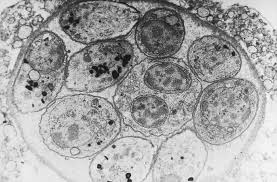 Understanding the different types of cancer in cats and learning to spot the symptoms is an essential part of being a proactive pet parent. Parasite Found In Undercooked Meat And Cat Poop May Be Linked To Rare Brain Cancer Smart News Smithsonian Magazine