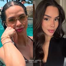 A diferença que faz um nariz mais delicado 😮‍💨🤌🏼 Rinomodelação  Estruturada: técnica permanente de Rinomodelação 👃🏼✨ ❗️Lembrando que:  cada nariz tem o formato mais lindo que ele pode ter. O resultado é