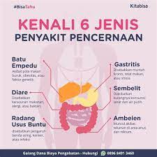 Gastritis superfisial akut merupakan respon mukosa lambung terhadap berbagai iritan lokal. Gastritis Merupakan Panyakit Karena Gangguan Gastritis Merupakan Panyakit Karena Gangguan Sistem Selain Itu Bisa Disebabkan Oleh Bakteri Kirtinaruka