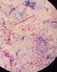 Mycobacterium Tuberculosis Afb Mikrobiyoloji Microbiology Microbiologia Microscope Laboratuvar Laborato Microbiology Tuberculosis Medical Terms