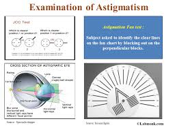 Examination Of Astigmatism Labmonk