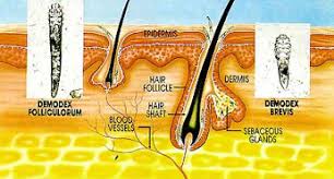 Image result for Demodex brevis