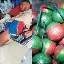 Dokumen penerbit gambar 1.9 teknik mengontrol bola. Remaja Cedera Parah Mercun Bola Meletup Secara Tiba Tiba Dalam Raga Motor