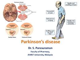 Definition of parkinson´s disease, epidemiology & etiology, pathophysiology, clinical assessment scales, differential diagnosis, therapy & prognosis. Parkinson S Disease