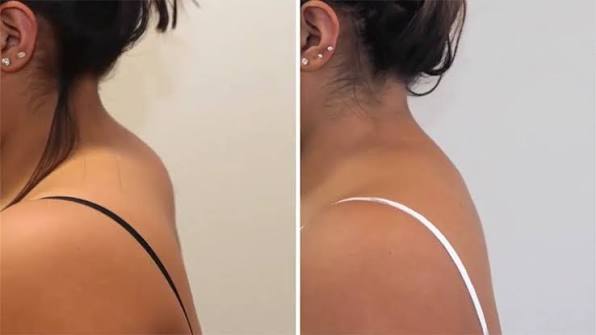 Dica ultra potente de como evitar o calombo no pescoço. Talvez vc já tenha  ouvido falar nela mas não deu a devida atenção. Essa dica aumenta  consideravelmente a chance de evitar o