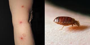 Here's how to find bed bugs there: You Can Have Bed Bugs And Not Know It Here S What To Look Out For Self