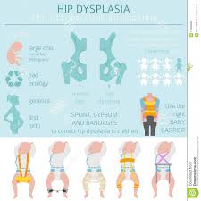 Foot Deformation Types Medical Desease Infographic Hip