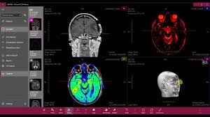 Acculite — (windows) free dicom viewer and basic browser for dicom datasets. 20 Free Open Source Dicom Viewers For Windows