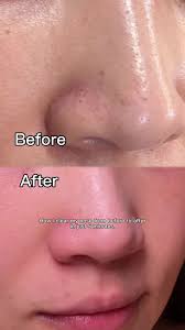 Kleen Out Sulfuric Acid How to Use