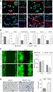 Asc Promote Emt And Motility In Human Prostate Cancer Cells A Direct Download Scientific Diagram