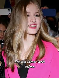 Princess Leonor and Her Leg