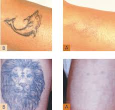Small agave aloe vera nature tattoo design. Tattoo Removal Aloe Vera Best Tattoo Ideas