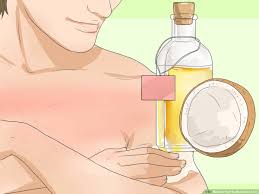 How To Turn Sunburn Into A Tan 12 Steps With Pictures Wikihow