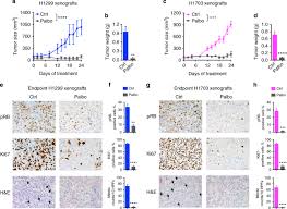 Lung cancer awareness month has come to a close but we encourage you to still spread hope through the lung cancer community. Smarca4 Loss Is Synthetic Lethal With Cdk4 6 Inhibition In Non Small Cell Lung Cancer Nature Communications