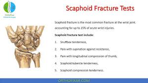 Image result for Scaphoid Shift Test