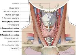 The most common treatment for swollen lymph nodes caused by a bacterial infection is antibiotics. Cervical Lymph Nodes Of The Neck