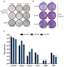 Sars was first reported in asia in february 2003. Viruses Free Full Text Propagation Inactivation And Safety Testing Of Sars Cov 2
