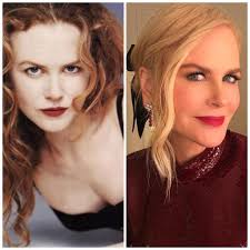 The american actress meg ryan is accused of undergoing plastic surgery. Stars That Changed A Lot After Plastic Surgery World Fashion Channel