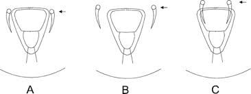 Image result for Embelia welwitschii