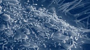 Image result for Lassa Fever