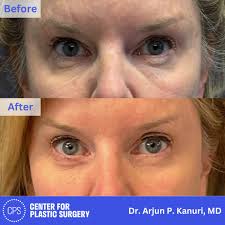 Center for Plastic Surgery