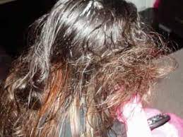 Biggest Hair Knot How To Get A Hair Knot Out Of Your Hair Youtube