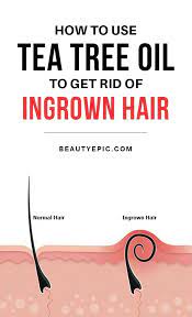 These occur when the tip of the hair grows back into the skin at the root instead of the surface. How Effective Is Using Tea Tree Oil For Ingrown Hair Ingrown Hair Tea Tree Oil For Acne Tea Tree Oil Hair