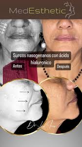 Instagram video by Dr.Luis Irias