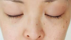 Manfaat madu hitam untuk kecantikan adalah dapat membuat kulit wajah menjadi lebih cerah sekaligus menghilangkan flek hitam. Cara Menghilangkan Flek Hitam Pada Wajah Menggunakan Bahan Alami