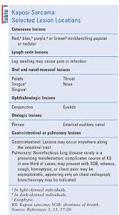 Despite its name, it is no longer classified as a sarcoma (which is a malignant tumour of mesenchymal origin) as it is due to multicentric vascular hyperplasia. Treatment Nuances For Kaposi Sarcoma In Older Adults