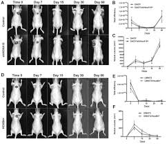 Cytoplasm, ribosomes, rough endoplasmic reticulum; Functional Analysis Of Hoxa10 And Hoxb4 In Human Medulloblastoma Cell Lines