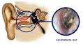 Scuba Dive Medical Articles Decompression, Heart Safety