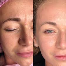 Bb glow serum is an excellent source of calcium, phosphorus, potassium, magnesium, manganese, zinc and zinc for use in all types of marine and looking for a good deal on bb glow serum? Bb Glow Kosmetikstudio Marilyn