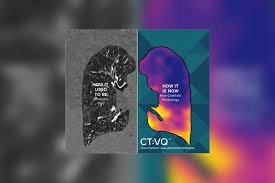 Image result for Ventilation Perfusion Scan