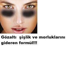 Gozalti Sislik Morluklari Icin Formul Goz Alti Morluklari Ozellikle Gozalti Sislikler Ve Torbalanmalarinda Homemade Beauty Care Homemade Skin Care Natural Mask