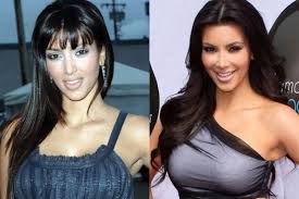 Kim kardashian has built an empire around herself as a brand. Utah Facial Plastics