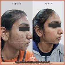 17 Photos of Dr. Ashutosh Pal-Arvind Skin Clinic in Manoramaganj, Indore
