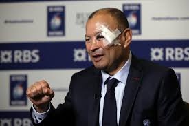 Des ieû z humides), s. Le Bel Oeil Au Beurre Noir D Eddie Jones Le Selectionneur De L Angleterre L Equipe