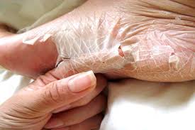 Most common work related disorder in the cosmetology profession caused from touching certain substances. Pictures Of 15 Uncommon Skin Conditions