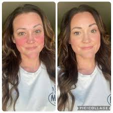 Favorite restore glow capsule results?