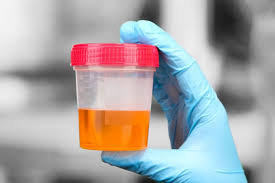 Sebagai contoh warna putih biasanya berarti. 10 Arti Warna Air Urine Terhadap Kesehatanmu Apakah Kamu Cukup Minum