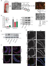 Estas a me morrer género: Preservation Of Stemness In High Grade Serous Ovarian Cancer Organoids Requires Low Wnt Environment Biorxiv