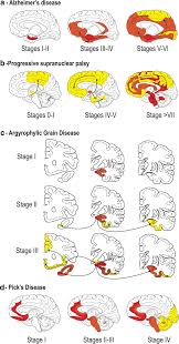 Chữ hán được cấu tạo từ các bộ thủ. From The Prion Like Propagation Hypothesis To Therapeutic Strategies Of Anti Tau Immunotherapy Springerlink