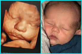It is fully formed and mostly filled out. 3d Ultrasound Testimonials 3d 4d Ultrasound In Ft Myers Fl