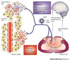 Image result for Cancer Pain