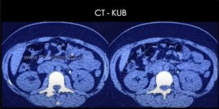 Academic Learning Of Urology Procedures - What Urologists Need to Know  About COVID-19
