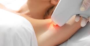 Hair free and carefree with laser hair removal in jupiter, palm beach gardens, & west palm beach. Laser Hair Removal In West Palm Beach Fl Laser Cinic