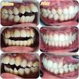 Kids Dentist/Pediatric Dentist in Dental Clinic in Dwarka product image
