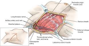 Technique Of Radical Mastectomy Plexus Products Mastectomy Arteries And Veins